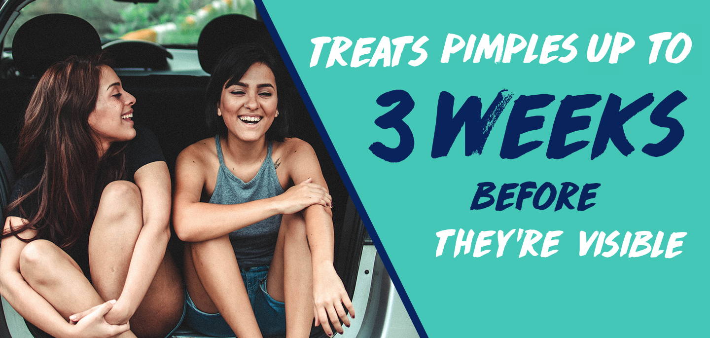 Treats pimples 3 weeks before they're visible