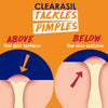 Clearasil Salicylic Acid Stubborn Acne Control Pads, 90 count